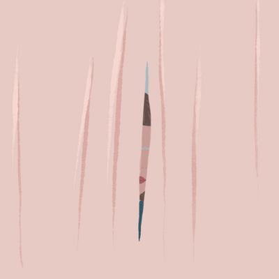 Ardência na vagina: principais causas e quando consultar um médico